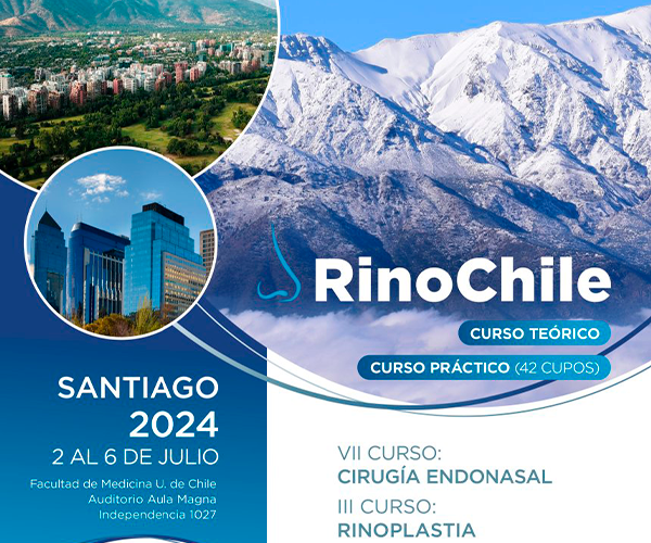 RinoChile